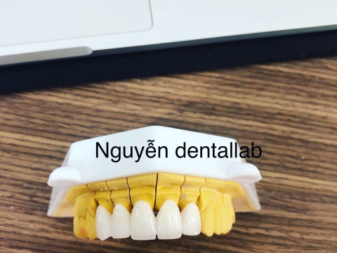 Sứ LAVA _Plus