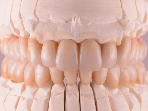 Răng sứ zirconia Ht