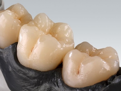Full contours_ zirconia ht