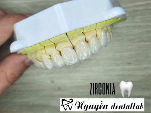 Răng sứ CerconHt- dentply